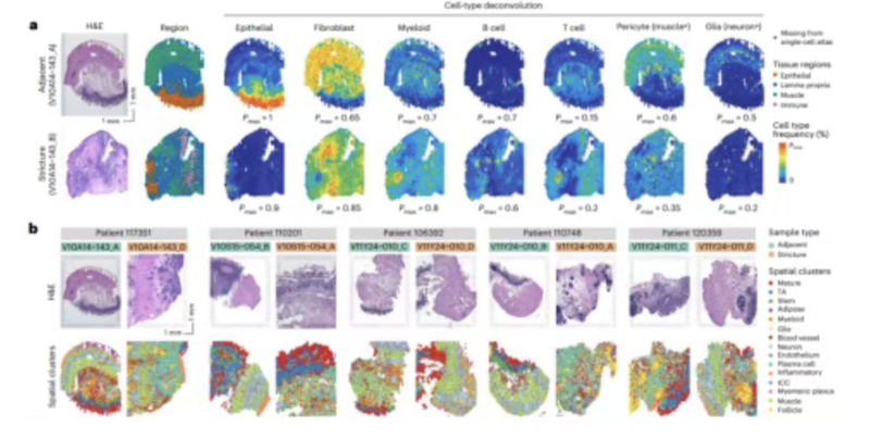 WindBlow-07YVGiwn-000171